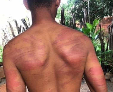Jovem de comunidade quilombola no Piauí denuncia agressões e PMs suspeitos são afastados